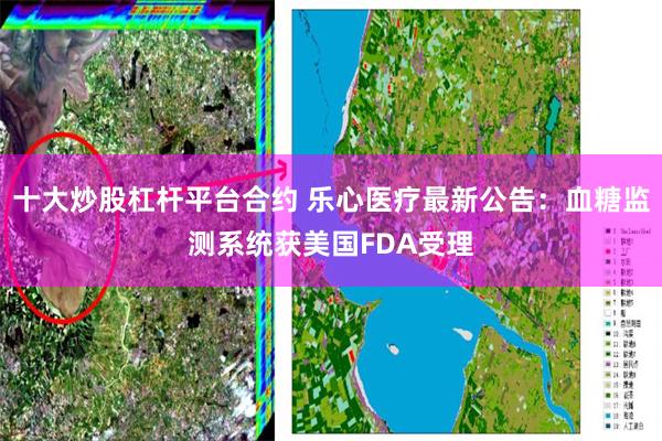 十大炒股杠杆平台合约 乐心医疗最新公告：血糖监测系统获美国FDA受理